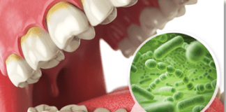 Yadda Ake Tsaftace Baki Tsaftace Baki