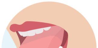 Idan Ƙuraje Suka Fito Min A Kan Harshena, Idan Na Goga Tumaturi Suna Warkewa, Shin Zan Iya Hakan Koda Ina Azumi? Ƙuraje