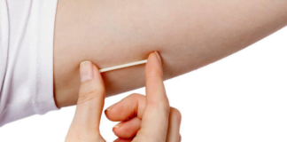 Contraceptive Implants : Ana Kiranta Ashanar Fata Da Hausa Wannan Wata Hanya Ce Da Ake Dasa Wani Roba Ƙarami A Hanun Mace Contraceptive Implants : Ana Kiranta Ashanar Fata Da Hausa Wannan Wata Hanya Ce Da Ake Dasa Wani Roba Ƙarami A Hanun Mace