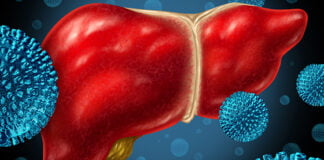 Ciwan Hanta {Hepatitis} Ciwan Hanta {Hepatitis}