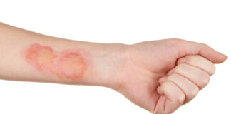 Jan Hankali Da Kuma Shawara Zuwa Ga ‘Yan Uwa Ƙananan Likitoci (Akan Infaction) Jan Hankali Da Kuma Shawara Zuwa Ga ‘Yan Uwa Ƙananan Likitoci (Akan Infaction)