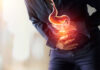Peptic Ulcer Diseases Peptic Ulcer Diseases