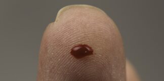 Tsayar Da Zubar Jini (Agajin Gaggawa) Tsayar Da Zubar Jini (Agajin Gaggawa)