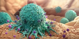 Kansar Bakin Mahaifa