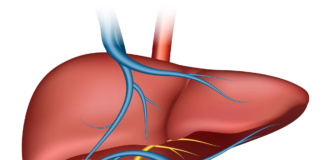 Matakan Kariya Daga Ciwon Hanta