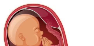 Shan Maganin Fitar Da Zaƙi Kafin Haihuwa