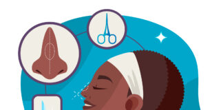 Ɓacewar Ashanar Hannu Ta Tazarar Haihuwa