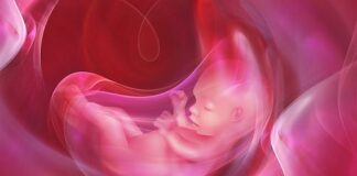 Abin Da Ke Jawo Jarirai Suna Shan Ruwan Haihuwa (AMNIOTIC FLUID)